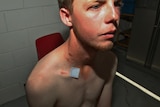 Police images of Dean Webber's injuries after the Alva Beach stabbing.