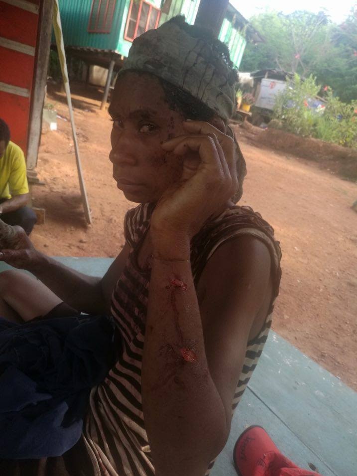 A photo of Brigita Mombi showing the wounds on her arms and head.