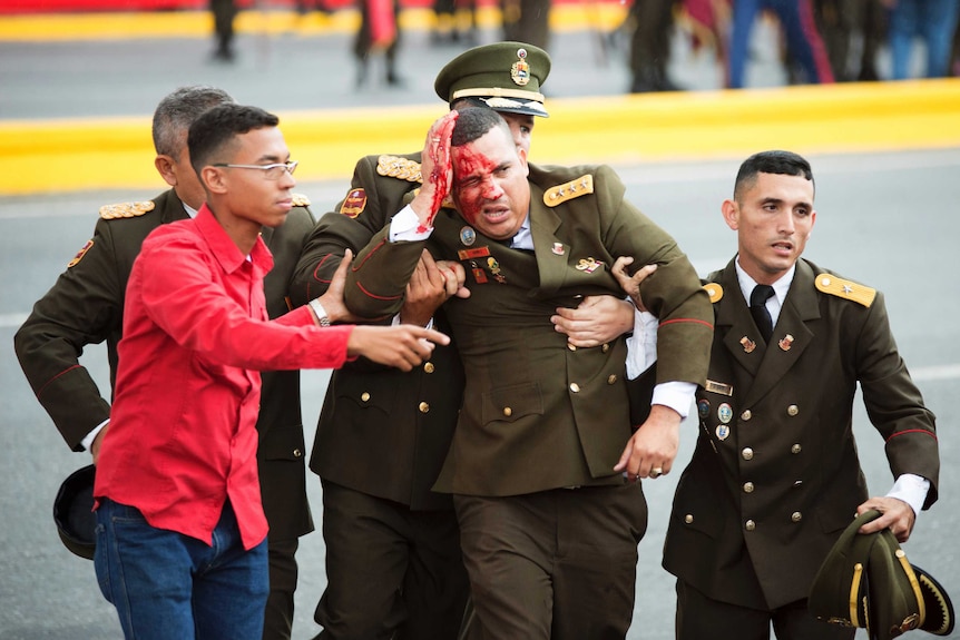 Venezuelan guard injured