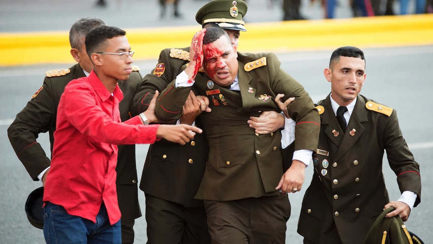Venezuelan guard injured