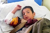 Boy with bloodied bandage around elbow on a hospital bed.