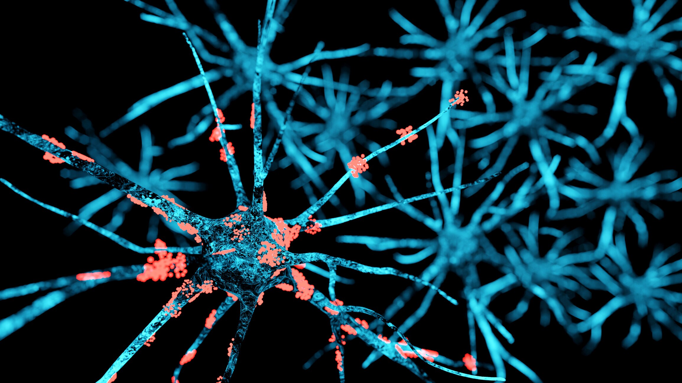 A stronger link between Parkinson disease and environmental ...