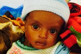 Three-month old baby Mohamed in Burao General Hospital