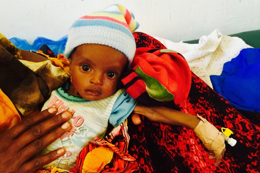 Three-month old baby Mohamed in Burao General Hospital