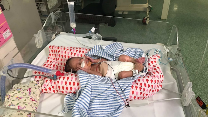 A baby in a cot in a hospital cot.