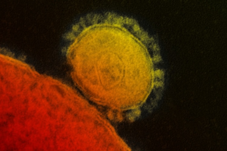 Transmission electron micrograph of Middle East Respiratory Syndrome coronavirus