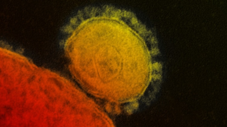 Transmission electron micrograph of Middle East Respiratory Syndrome coronavirus