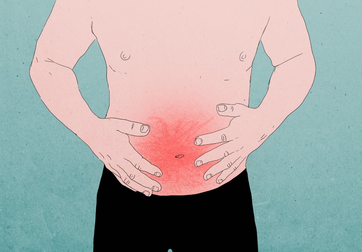 Illustration of a shirtless man with stomach pain