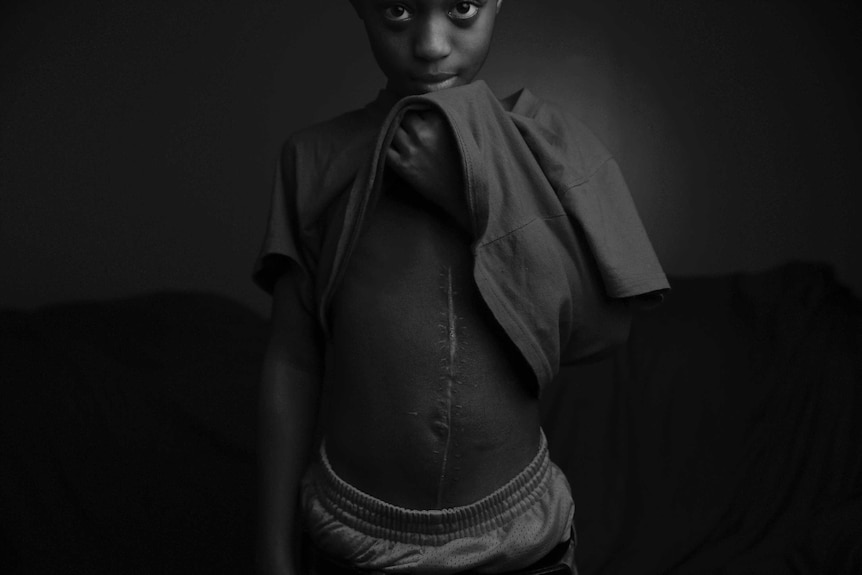 A photograph of a young boy who survived a shooting in chicago