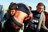 Palestinians carry a wounded man to a stretcher