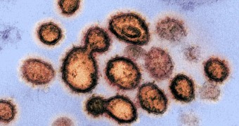 A virus under a microscope
