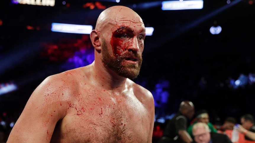 A boxer stands in the ring, bleeding heavily, after winning his heavyweight boxing bout.