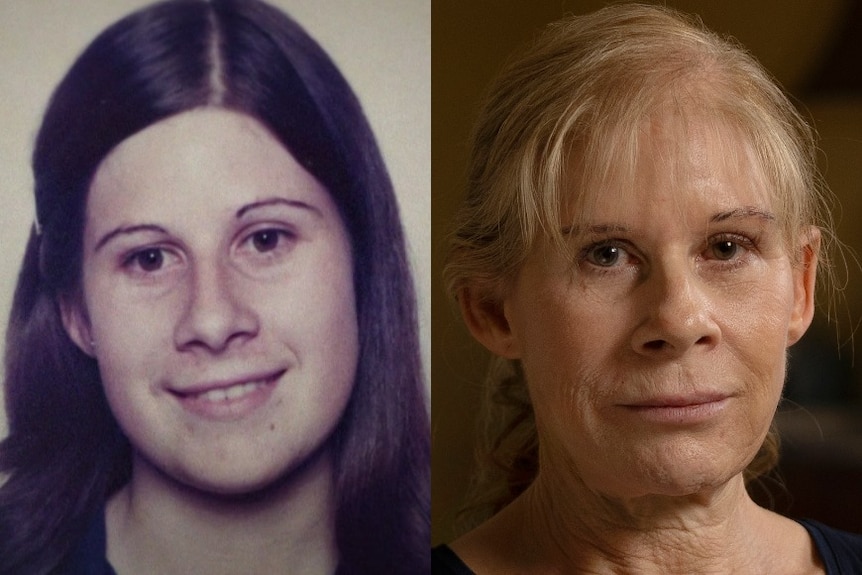 A composite image of a woman in 1979 and now.