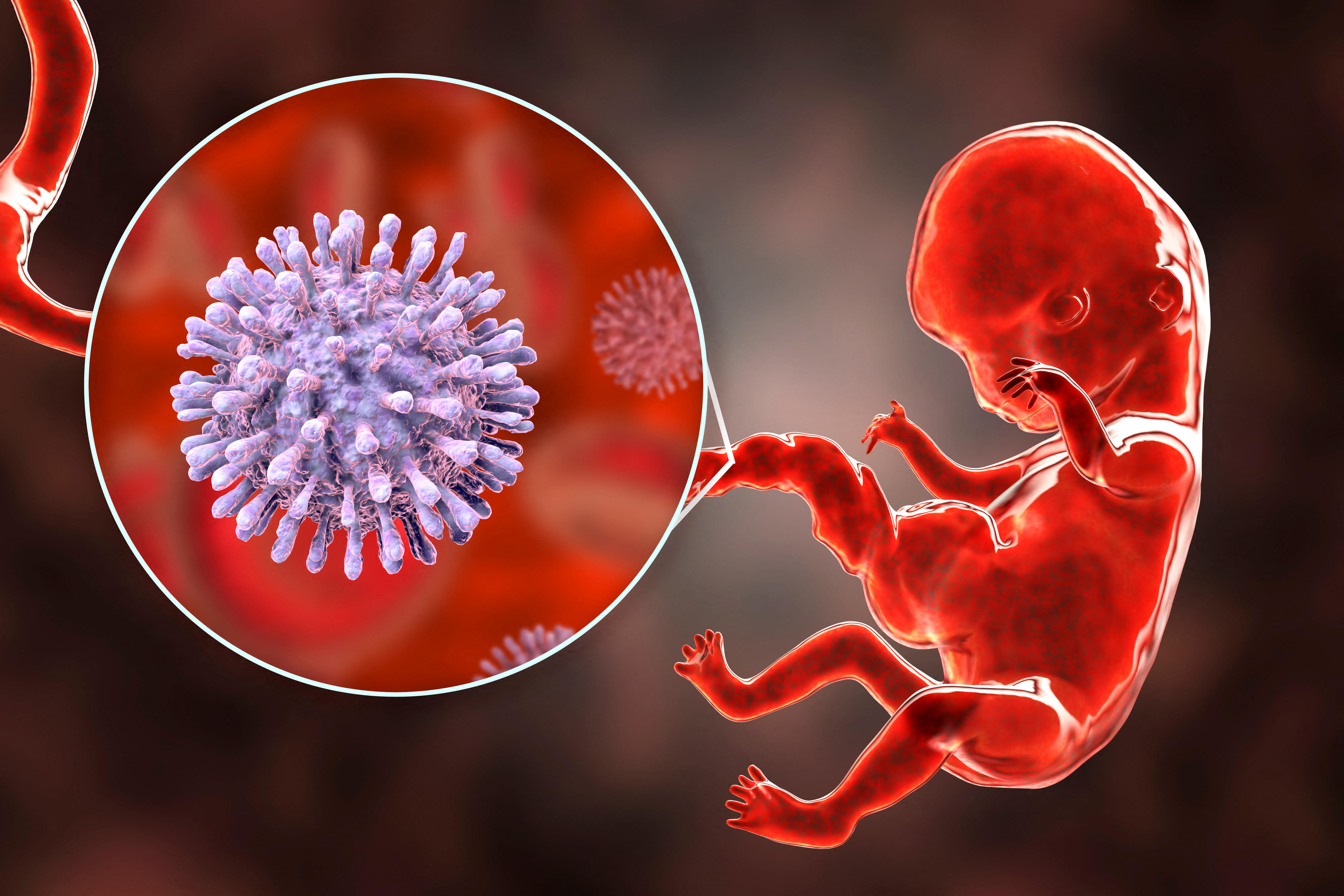 Human immunodeficiency viruses (HIV) infecting human embryo, an illustration showing a baby and molecule.
