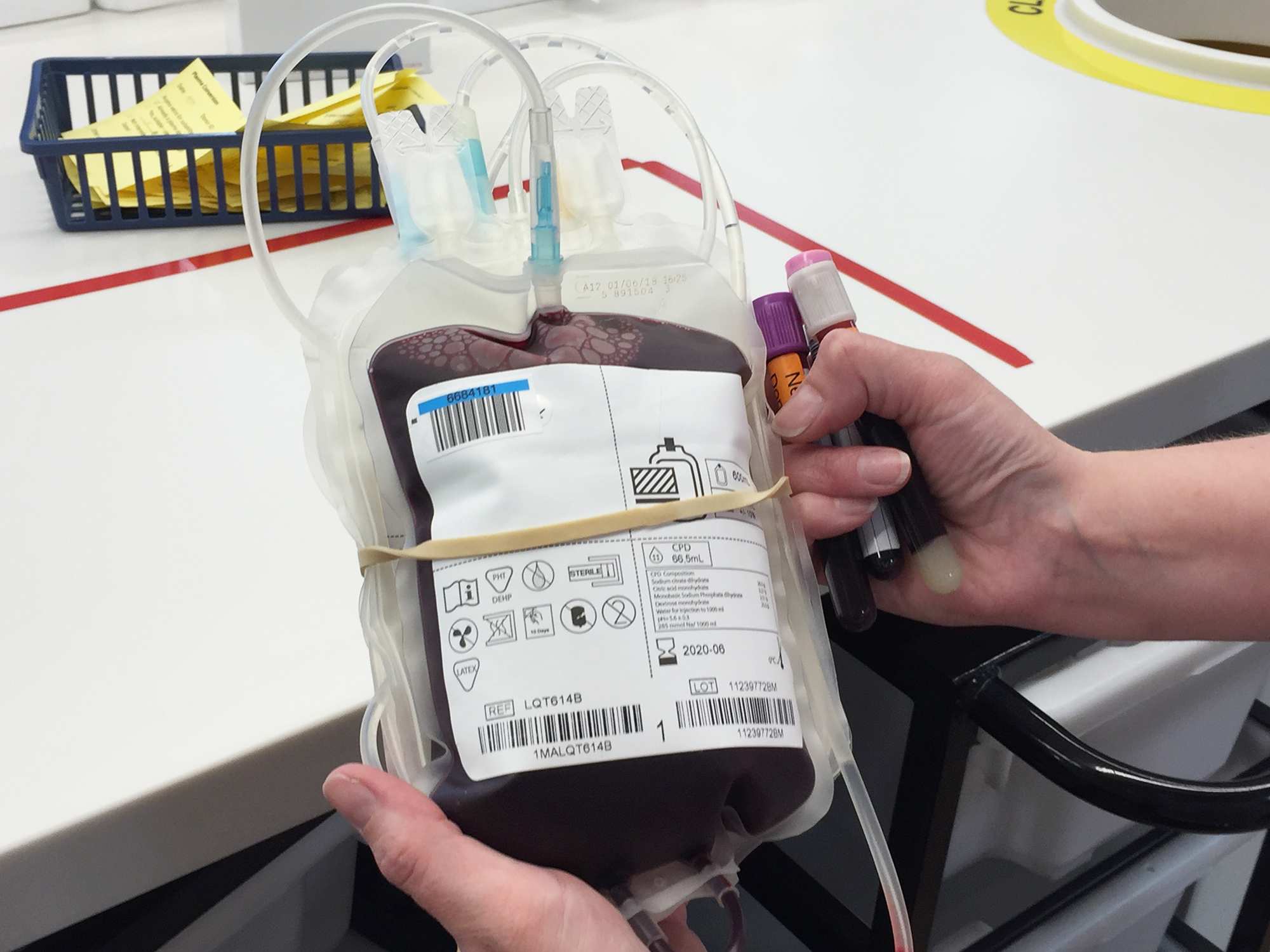 Bag of blood from transfusion.