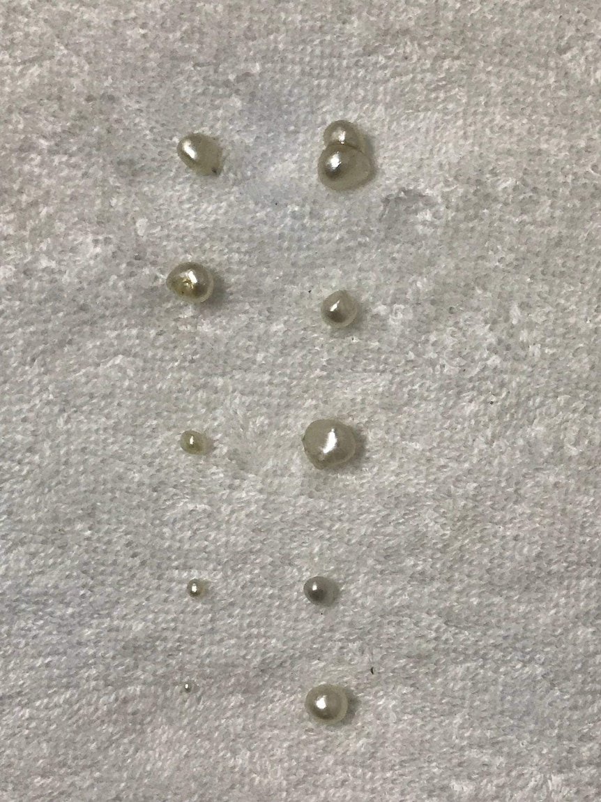 A close up of 10 natural pearls