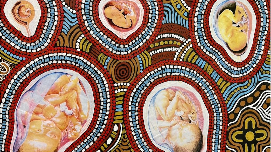 A painting with unborn babies in wombs