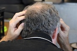 Balding man rubs the back of his head, looking stressed.