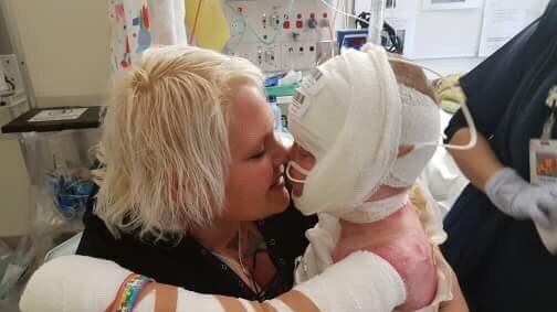 Mother hugging her son, who is in hospital with bad burns and body wrapped in bandages