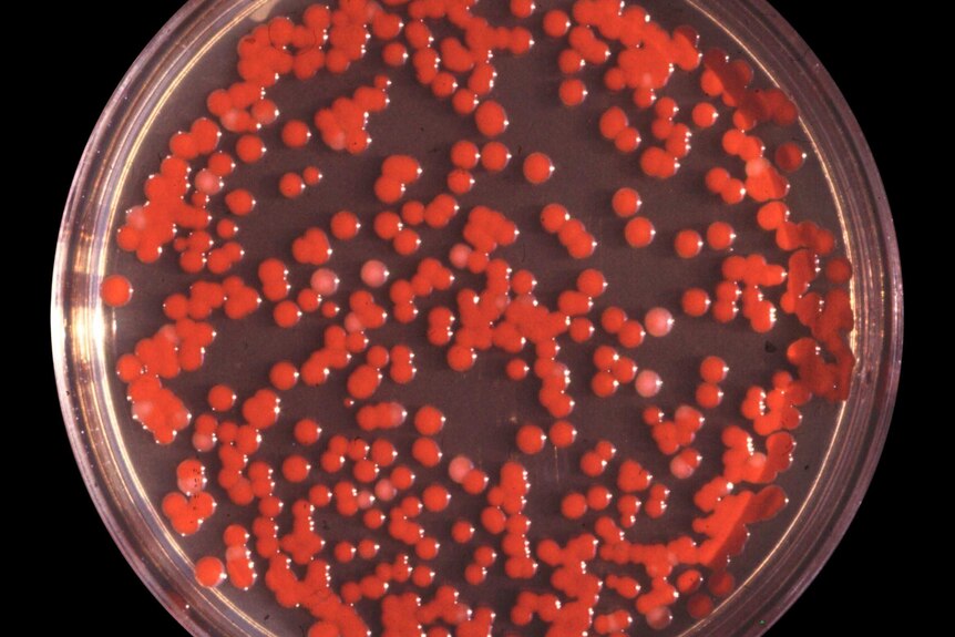 Blood-red colonies of bacteria growing in agar gel in a circular plastic dish.