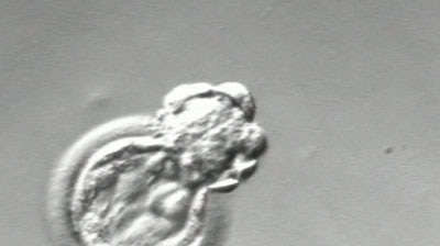 An early stage embryo