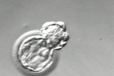 An early stage embryo