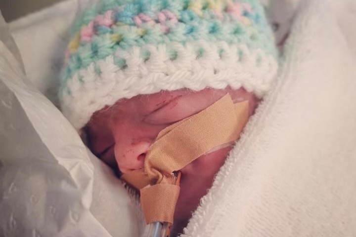 Small baby wears knitted beanie. Tape holds a tube in his mouth.