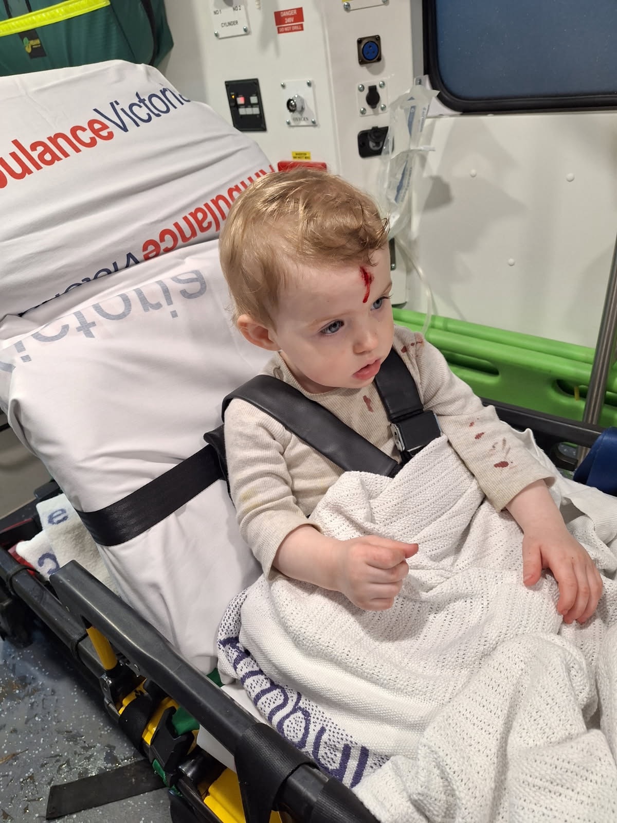 Toddler waits seven hours for stitches during patient surge