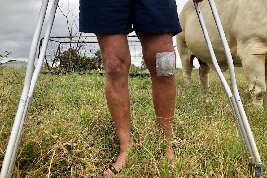 A photo of the man's knees as he stands on crutches with cow legs behind him.