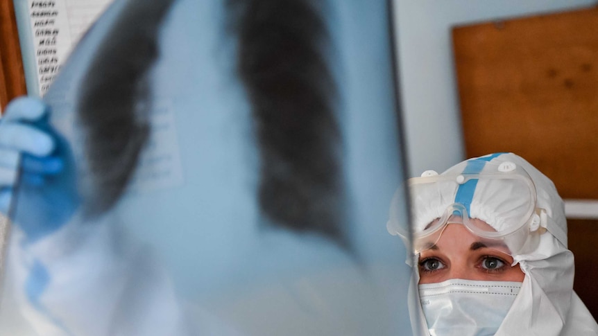 A doctor checking an x-ray of a COVID-19 patient's lungs