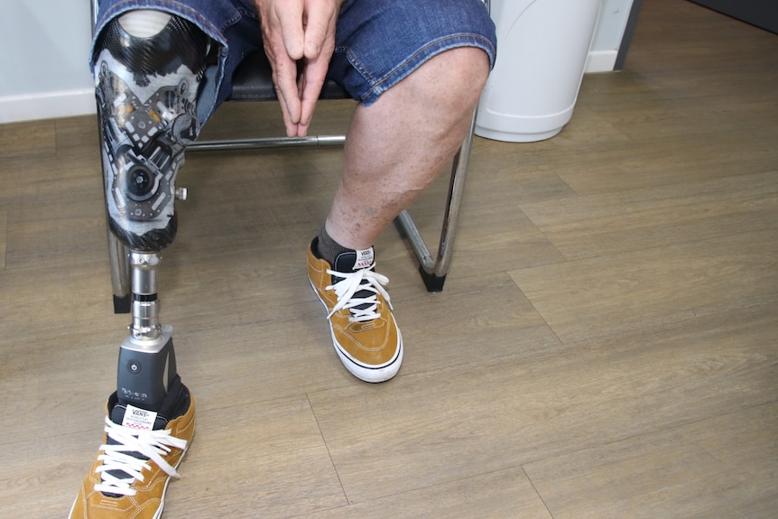 A metallic prosthetic leg decorated as a bike engine 