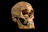 The skull of King Richard III.