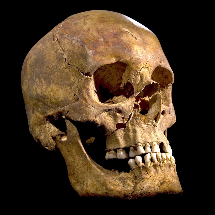 The skull of King Richard III.