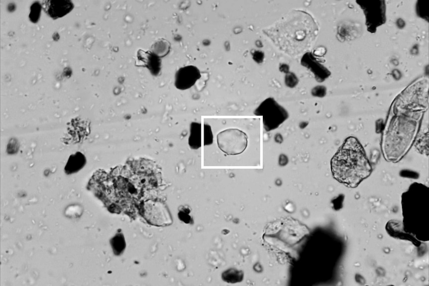 View of microscope slide with Theobroma spp. starch grain (in box), among other particles in the residues