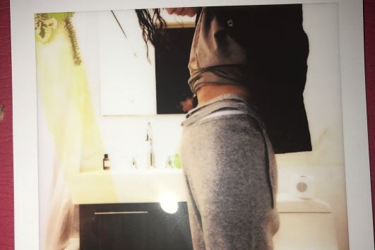 In a polaroid photo, Gomez stares down at the new scar on her abdomen