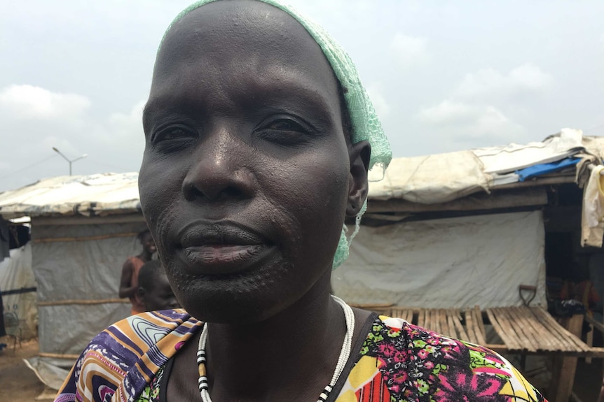 A South Sudanese woman wearing a green scarf with traditional tribal scarring on her face.