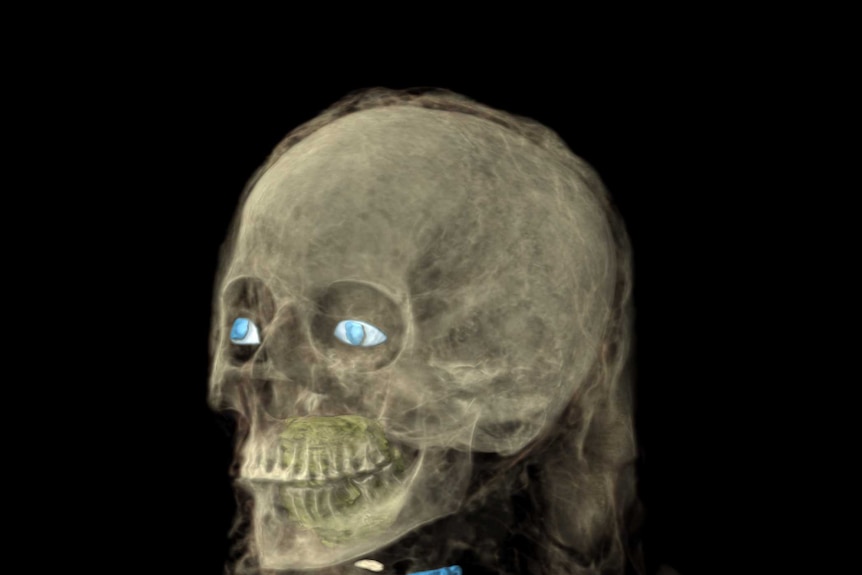 Xray of a mummy shows the heart