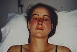 Corinna Horvath in hospital after she was bashed by Victorian police officers in 1996.