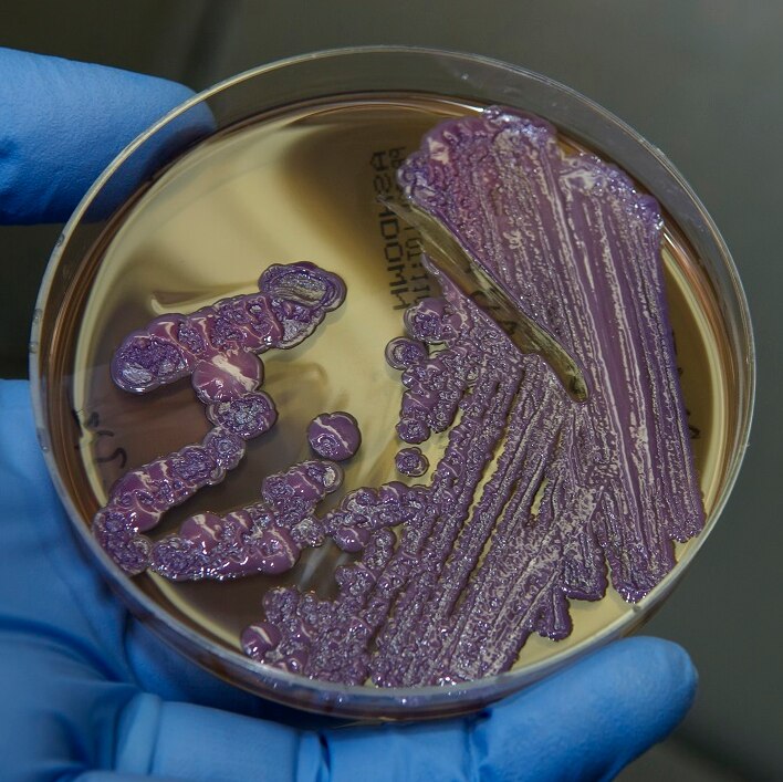 A slide of melioidosis bacteria being tested by a researcher