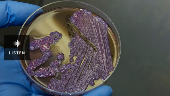 A slide of melioidosis bacteria being tested by a researcher. Has Audio.