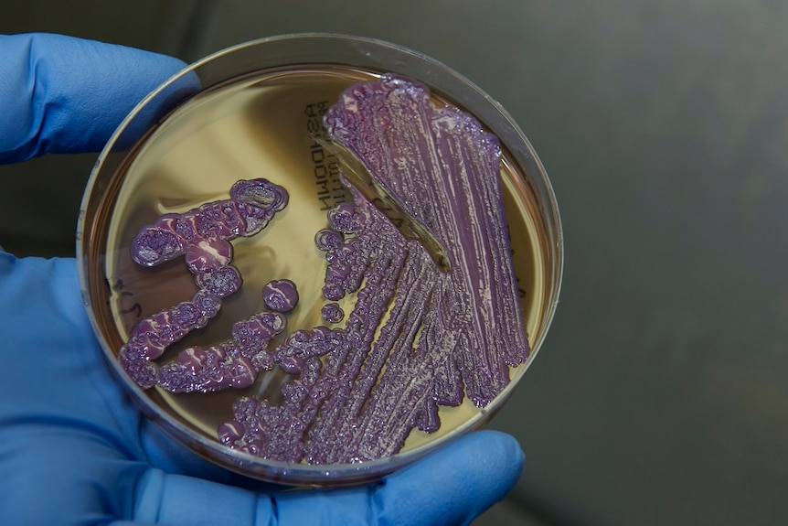 A slide of melioidosis bacteria being tested by a researcher