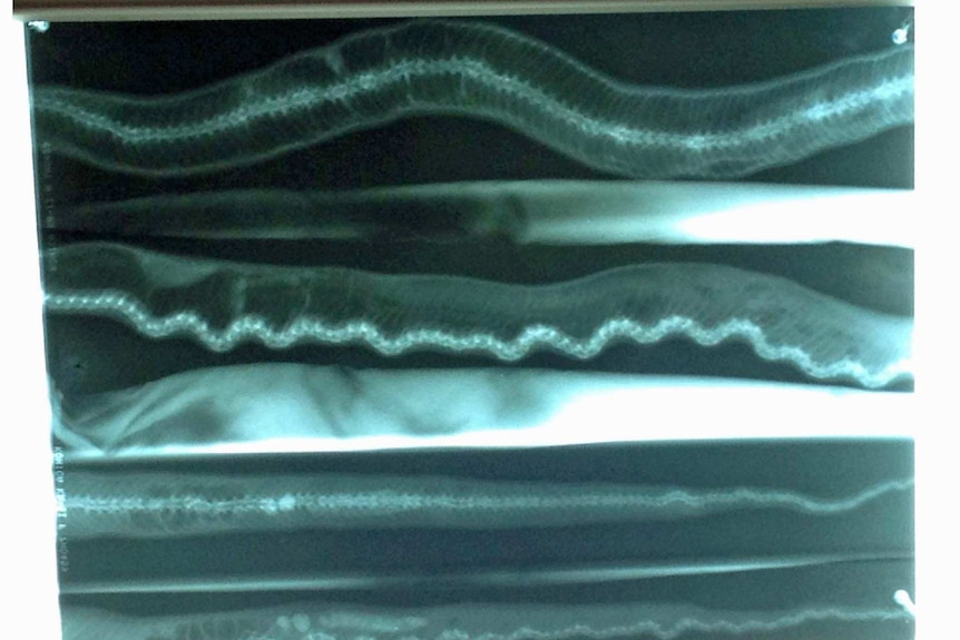 X-ray of a Tasmanian tiger snake diagnosed Charcot's disease which causes spinal lumps.