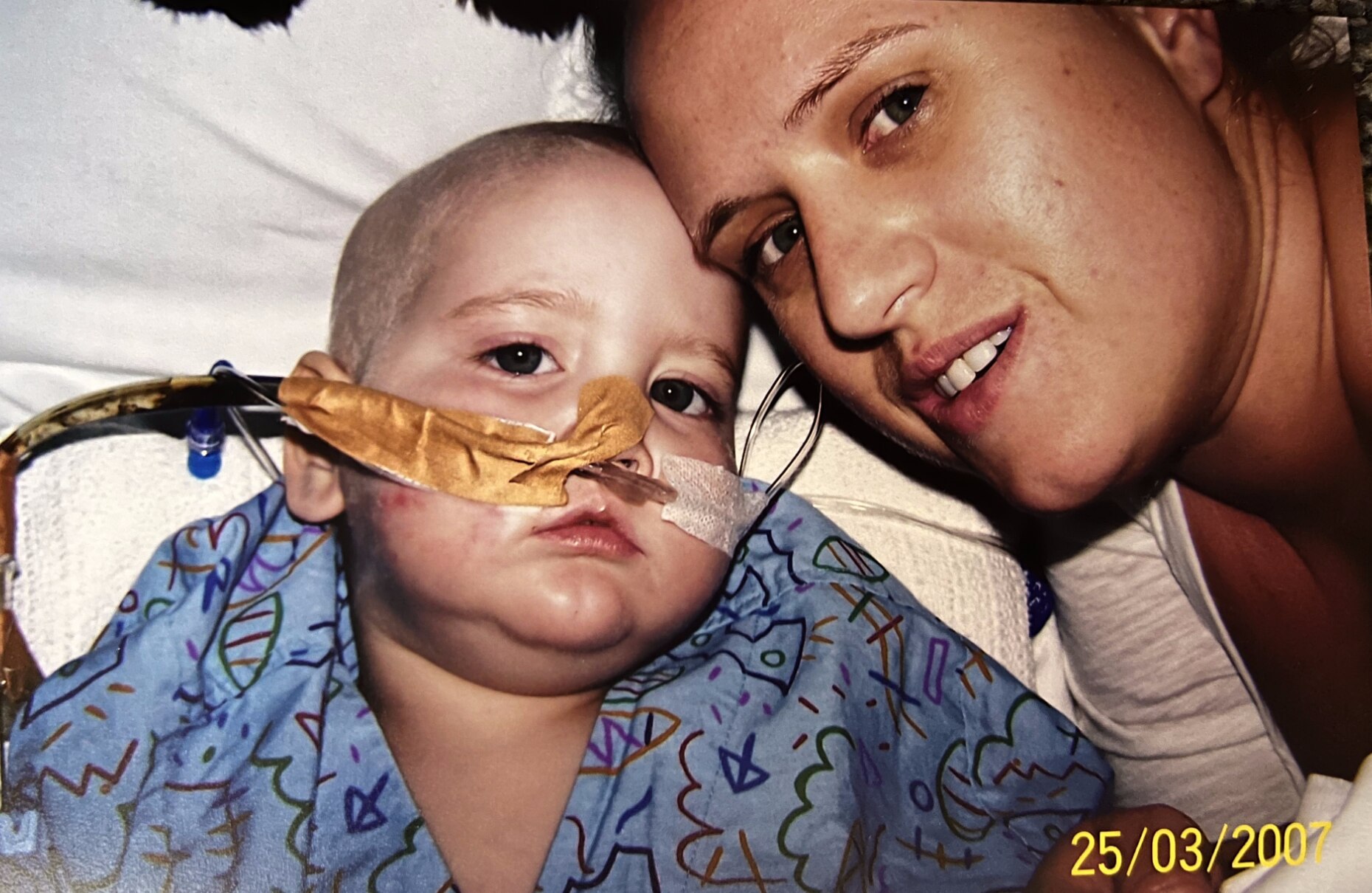 A young boy with no hair and a tube in his nose sits in a hospital bed with his mum beside him