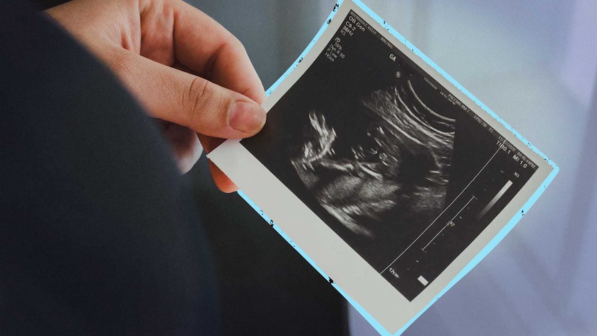 Unidentified woman in foreground holding black and white holding ultrasound of baby scan with blue line around the scan