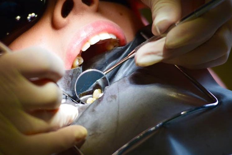 A child has their teeth examined by a dentist.