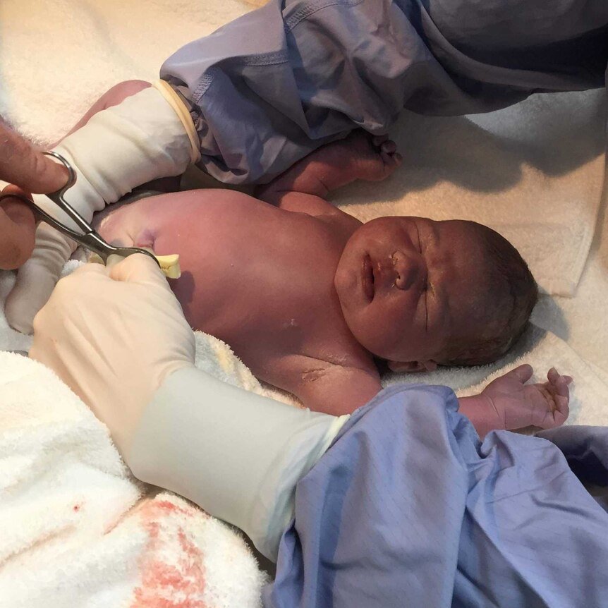 A newborn baby lies on a table as the umbilical cord is tied off.