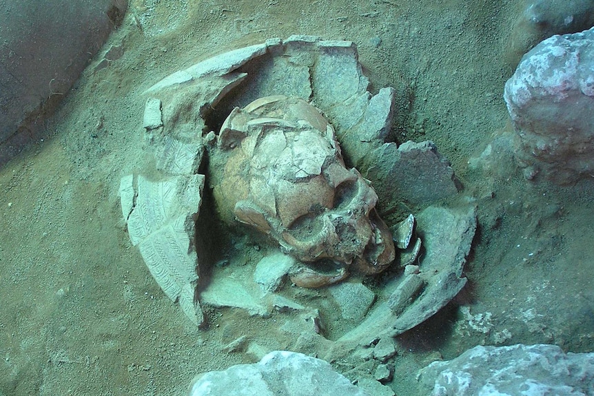 Skull and mandible of 3,000 year old person from Vanuatu