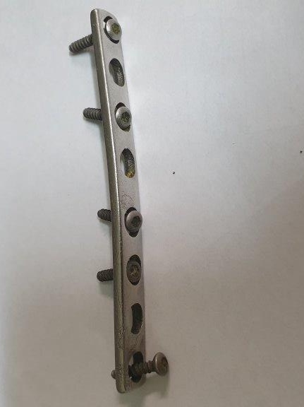 orthopaedic steel plate and six screws