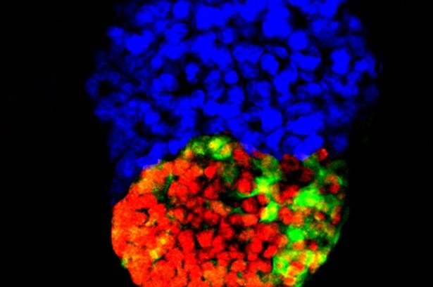 The artificial mouse 'embryo' at 100 hours.