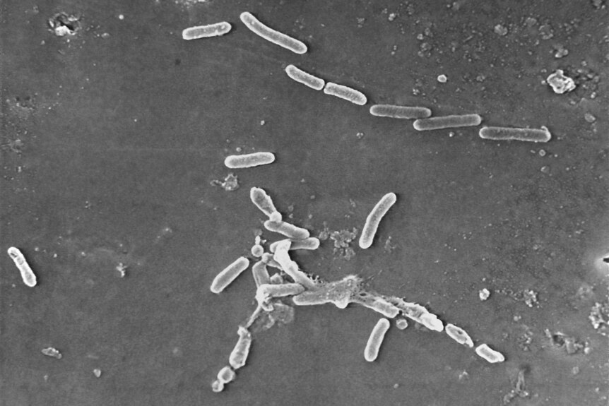 A black-and-white microscopic image of the Pseudomonas aeruginosa bacteria.